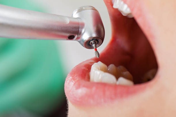 Best Walk-In Emergency Dental Services in Pierce, CO